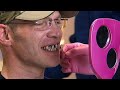 Generous tip buys new teeth for waiter