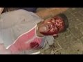 Police investigating black student's bloody arrest