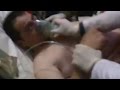 Chlorine gas attack reported in Syria